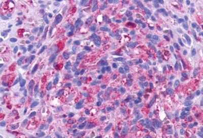 Immunohistochemistry-Paraffin: TEM5/GPR124 Antibody - BSA Free [NLS2171]