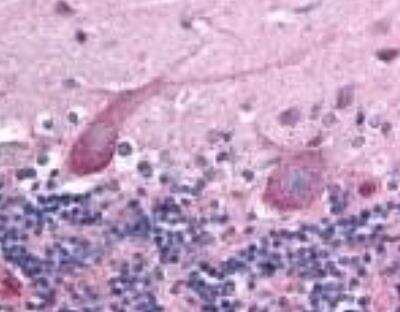 Immunohistochemistry: TEM7/PLXDC1 Antibody (197C193 (IM193)) - Azide Free [NBP2-33228]