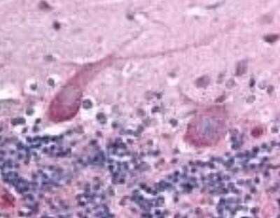 Immunohistochemistry: TEM7/PLXDC1 Antibody (197C193 (IM193)) - BSA Free [NB100-56557]