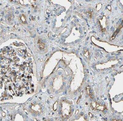 Immunohistochemistry-Paraffin: TEM7/PLXDC1 Antibody [NBP1-86954]