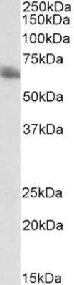 Western Blot: TEM8/ANTXR1 Antibody (200C1339(SB20))BSA Free [NB100-56585]