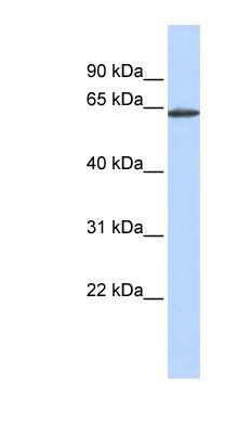 Western Blot: TEM8/ANTXR1 Antibody [NBP1-62488]