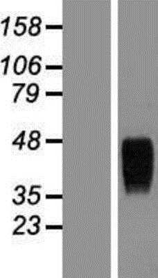 Western Blot: TEM8/ANTXR1 Overexpression Lysate [NBP2-05826]