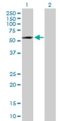 Western Blot: TENR Antibody [H00132612-B01P]