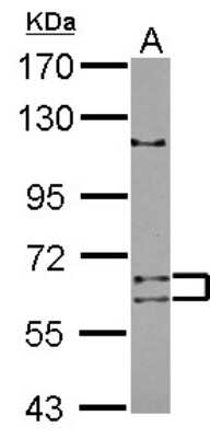 Western Blot: TENR Antibody [NBP2-20598]