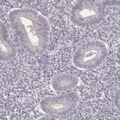 Immunohistochemistry-Paraffin: TEPP Antibody [NBP2-57214]