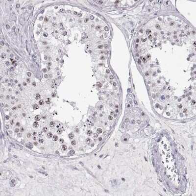 Immunohistochemistry-Paraffin: TEPP Antibody [NBP2-57214]