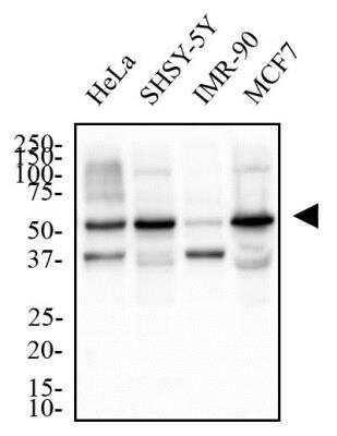 Western Blot: TERF2IP Antibody [NB100-56321]
