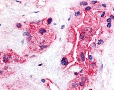 Immunohistochemistry: TERT Antibody (2C4) - Azide and BSA Free [NBP2-80975]