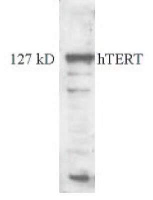 Western Blot: TERT Antibody (2C4) [NB100-317]