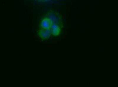 Immunocytochemistry/ Immunofluorescence: TERT Antibody (2D8) [NB100-297]