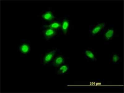 Immunocytochemistry/ Immunofluorescence: TESK2 Antibody (1A8) [H00010420-M01]