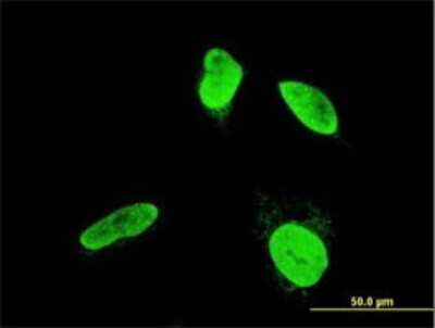 Immunocytochemistry/ Immunofluorescence: TESK2 Antibody (5H4) [H00010420-M04]