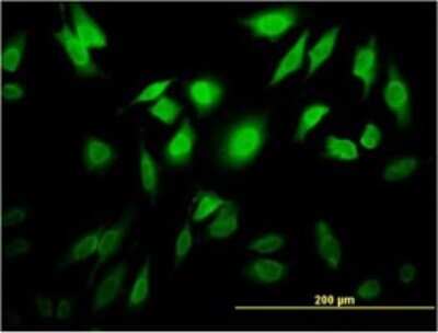 Immunocytochemistry/ Immunofluorescence: TESK2 Antibody (6C7) [H00010420-M02]