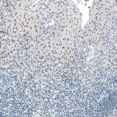 Immunohistochemistry-Paraffin: TET2 Antibody (CL6873) [NBP2-76510]