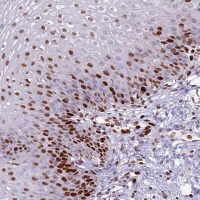 Immunohistochemistry: TETRAN Antibody [NBP2-47607]