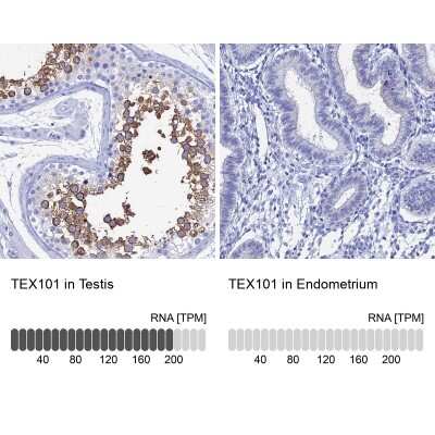 Immunohistochemistry-Paraffin: TEX101 Antibody [NBP1-84356]