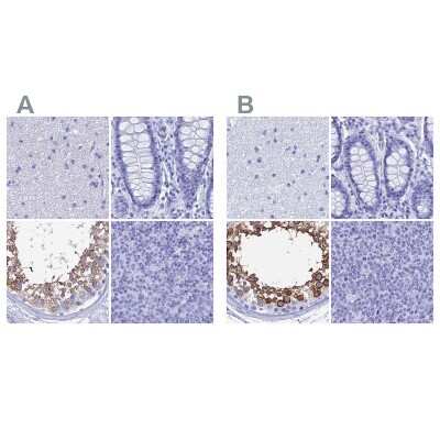 Immunohistochemistry-Paraffin: TEX101 Antibody [NBP1-84356]