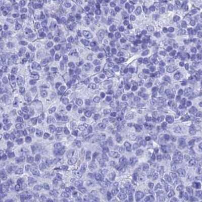 Immunohistochemistry-Paraffin: TEX101 Antibody [NBP1-84356]