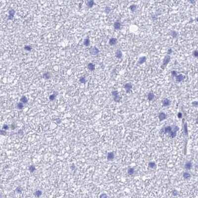 Immunohistochemistry-Paraffin: TEX101 Antibody [NBP1-84356]