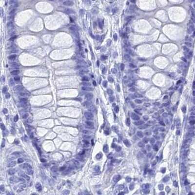 Immunohistochemistry-Paraffin: TEX101 Antibody [NBP1-84356]