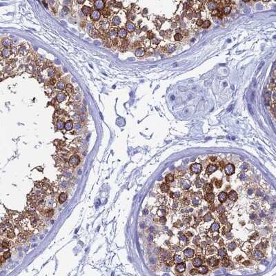 Immunohistochemistry-Paraffin: TEX101 Antibody [NBP1-84357]