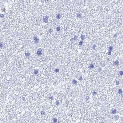 Immunohistochemistry-Paraffin: TEX101 Antibody [NBP1-84357]