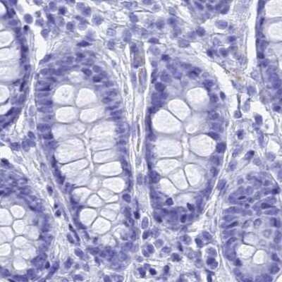 Immunohistochemistry-Paraffin: TEX101 Antibody [NBP1-84357]