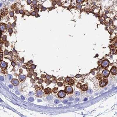Immunohistochemistry-Paraffin: TEX101 Antibody [NBP1-84357]