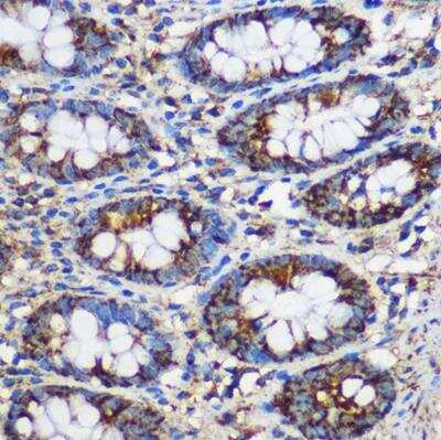 Immunohistochemistry-Paraffin: TEX101 Antibody - Azide and BSA Free [NBP2-94471]