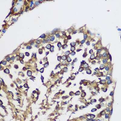 Immunohistochemistry-Paraffin: TEX101 Antibody - Azide and BSA Free [NBP2-94471]