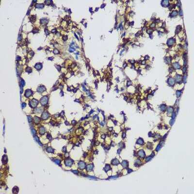 Immunohistochemistry-Paraffin: TEX101 Antibody - Azide and BSA Free [NBP2-94471]