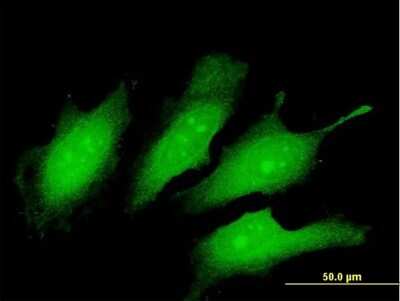 Immunocytochemistry/ Immunofluorescence: TEX13A Antibody [H00056157-B01P]