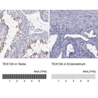 Immunohistochemistry-Paraffin: TEX13A Antibody [NBP2-62675]