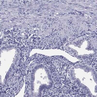 Immunohistochemistry-Paraffin: TEX13A Antibody [NBP2-62675]