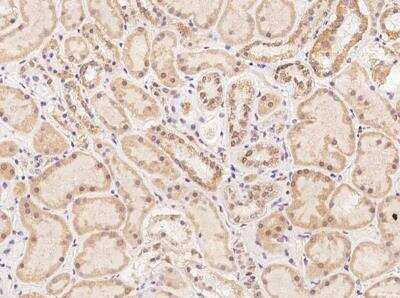 Immunohistochemistry-Paraffin: TEX13B Antibody [NBP3-06129]