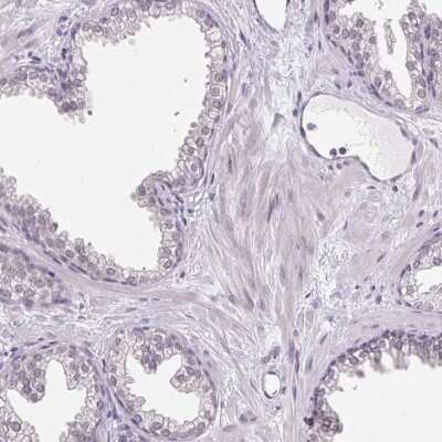 Immunohistochemistry-Paraffin: TEX15 Antibody [NBP1-84347]