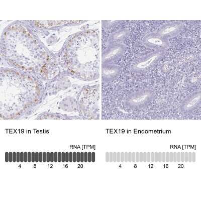 Immunohistochemistry-Paraffin: TEX19 Antibody [NBP2-30835]