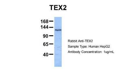 Western Blot: TEX2 Antibody [NBP1-59977]