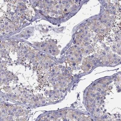 Immunohistochemistry-Paraffin: TEX22 Antibody [NBP2-38069]