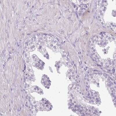 Immunohistochemistry-Paraffin: TEX30 Antibody [NBP2-30640]