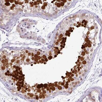 Immunohistochemistry-Paraffin: TEX30 Antibody [NBP2-30640]