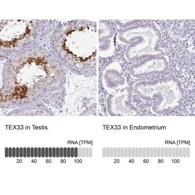 Immunohistochemistry-Paraffin: TEX33 Antibody [NBP1-81096]