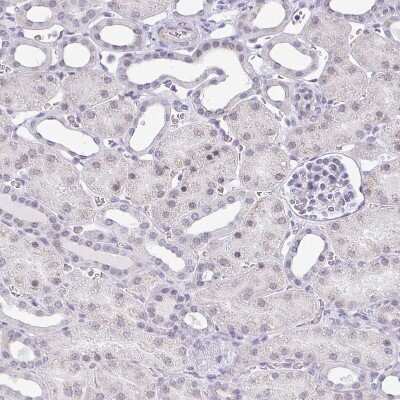 Immunohistochemistry-Paraffin: TEX33 Antibody [NBP1-81096]