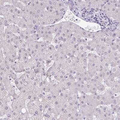 Immunohistochemistry-Paraffin: TEX33 Antibody [NBP1-81096]