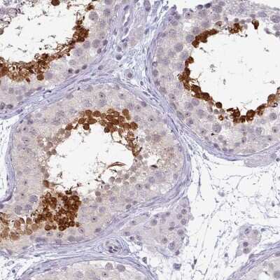 Immunohistochemistry-Paraffin: TEX33 Antibody [NBP1-81096]