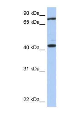 Western Blot: TEX9 Antibody [NBP1-56553]