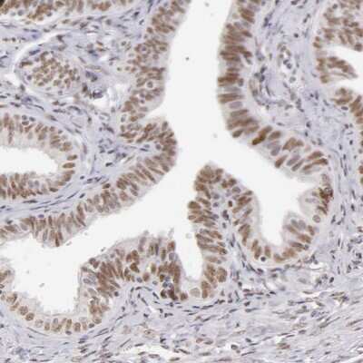 Immunohistochemistry-Paraffin: TFAP4 Antibody [NBP1-89060]