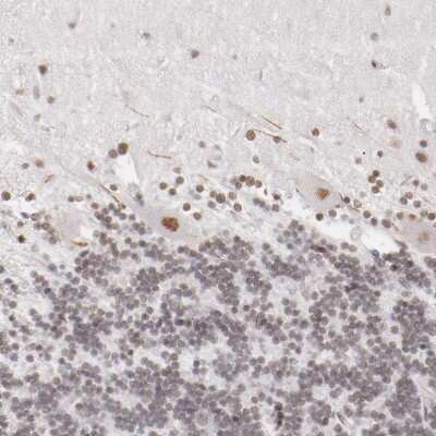 Immunohistochemistry-Paraffin: TFAP4 Antibody [NBP1-89060]