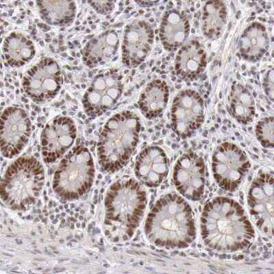 Immunohistochemistry-Paraffin: TFAP4 Antibody [NBP1-89060]